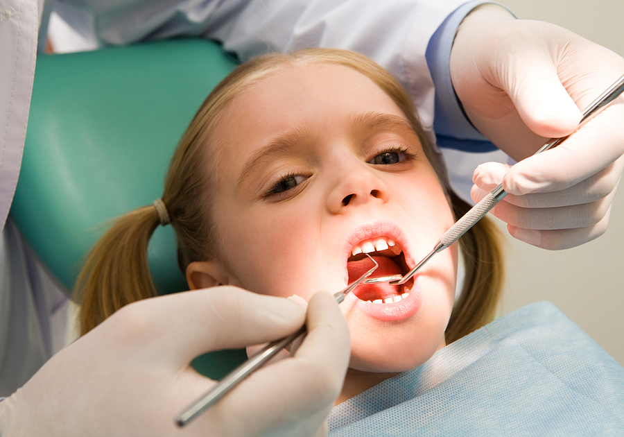 Dental Sealants: How They Protect Your Teeth from Cavities